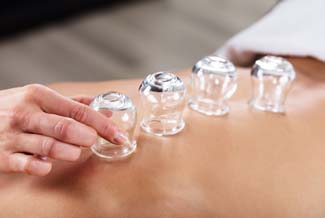 Cupping Therapies